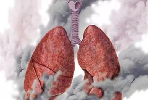 肺癌晚期表现症状有什么