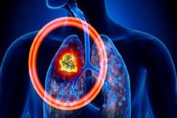 肺癌出现脑转移后应给如何具体处理？