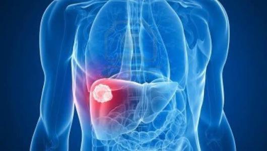 肝病科医生提醒：不想肝炎变肝癌，日常要做到“三多四少”