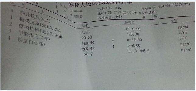 CA199是什么，CA199偏高说明什么问题？