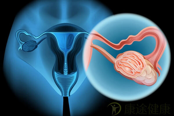 2021年了，晚期卵巢癌有哪些药可用，怎么用？